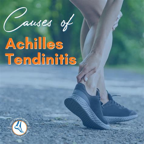 What Causes Achilles Tendinitis Foot And Ankle Centers Of Frisco And Plano