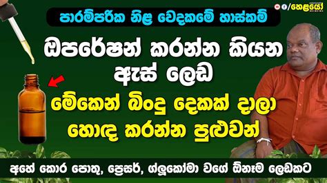 ඔපරේෂන් කරන්න කියන ඇස් ලෙඩ මේකෙන් බිංදු දෙකක් දාලා හොඳ කරන්න පුළුවන්