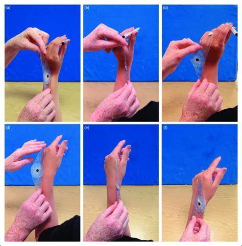 Goniometer Measurements