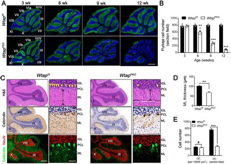 Degeneration Of Pcs In Wtap Pko Mice A Immunofluorescence Labeling Of