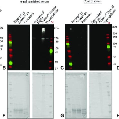 Alpha Gal Immunoglobulin E Ige Reactivity Toward Commercially