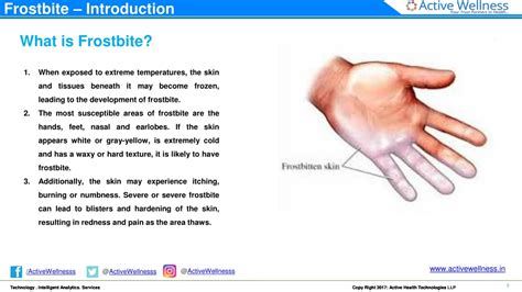 Ppt Frostbite Causes And Treatment Active Health Powerpoint