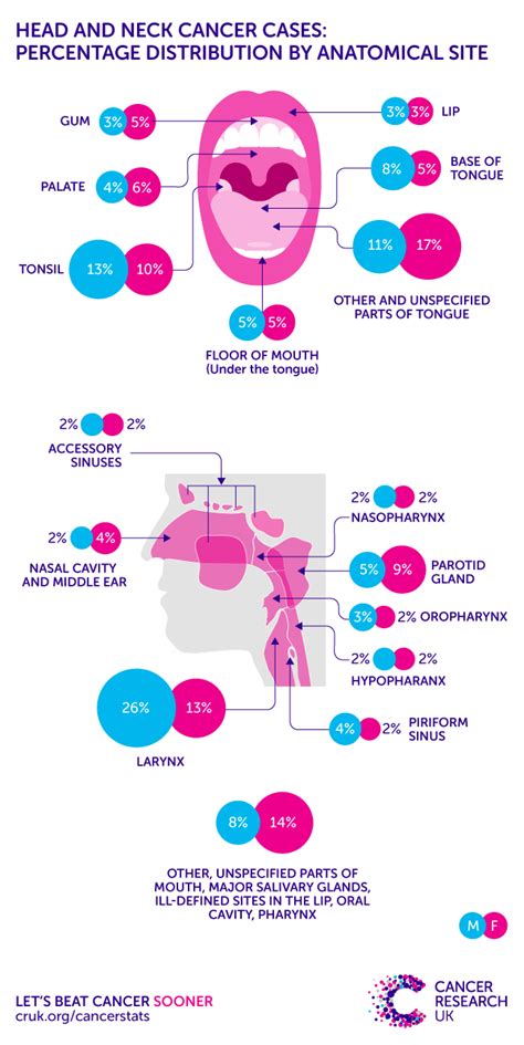 Infographic Showing Head And Neck Cancers By Anatomical Site Neck