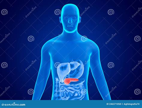 Human Body Blue Hologram Pancreatitis Is A Serious Inflammation Of The