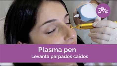 Ent Rate C Mo Es El Tratamiento De Plasma Pen Para P Rpados