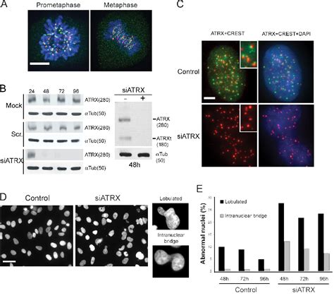 Figure From Loss Of Atrx Leads To Chromosome Cohesion And Congression