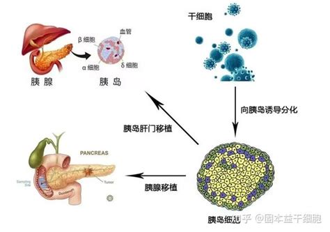 世界糖尿病日：干细胞对糖尿病及其并发症的研究进展 知乎