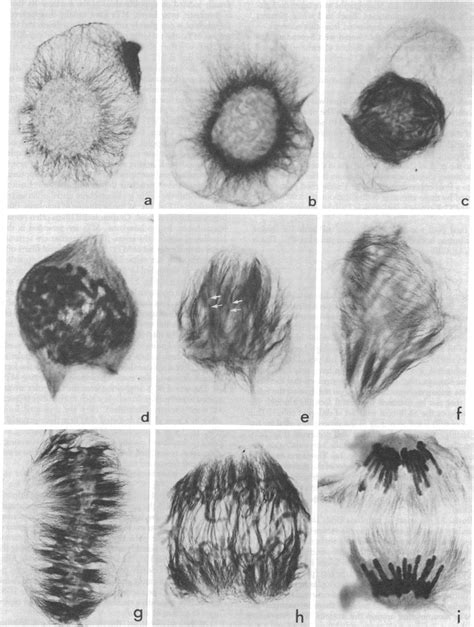 Mitosis Under Microscope Labeled