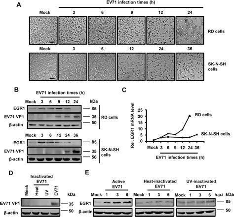 Regulation Of EGR1 Expression During EV71 Infection AC RD Or