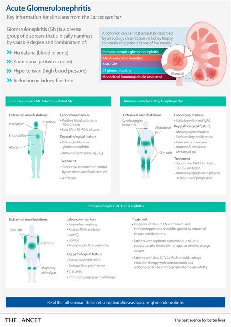 Infographic Including Key Information For Clinicians From The Lancet