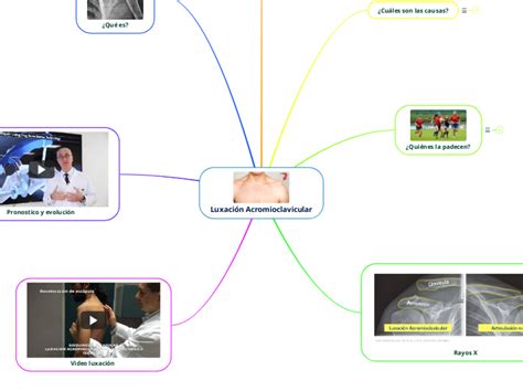 Luxaci N Acromioclavicular Adimen Mapa