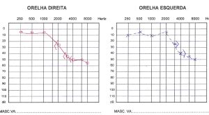 Audiometria Tonal Limiar E Vocal Cl Nica Orel