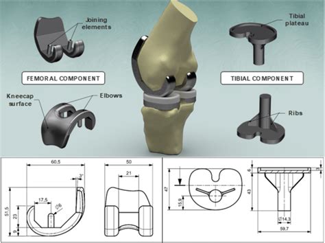 Knee Main Components And Dimensions Femoral And Tibial Components Download Scientific Diagram