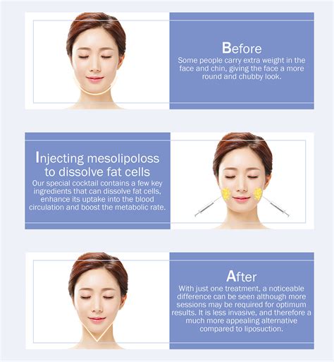 Face Slimming | Clinic RX