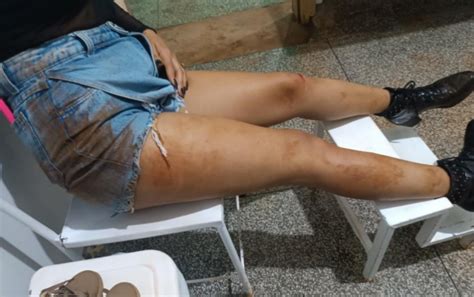 Adolescente é agredida pelo marido socos enquanto amamentava bebê