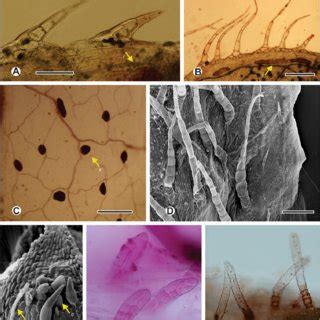 A G Trichomes And Resin Ducts Of Heterosperma Cav A Foliar Short