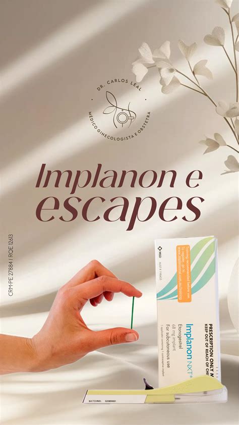 Quanto Tempo O Implanon Faz Efeito