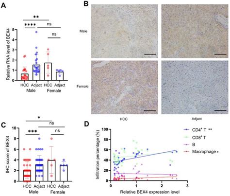 Sex Differences In Hepatocellular Carcinoma Indicated BEX4 As A