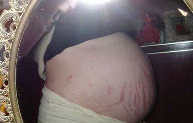 Vergeture Grossesse ZB Porn