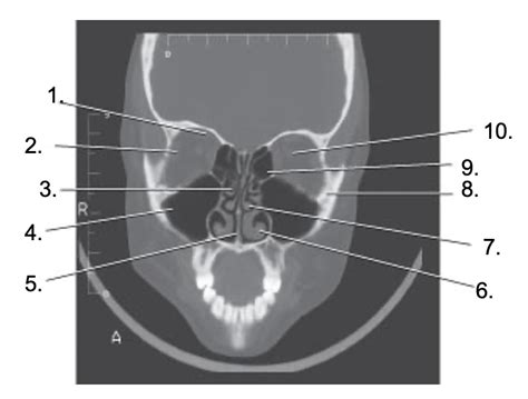 Rtt Face Diagram Quizlet