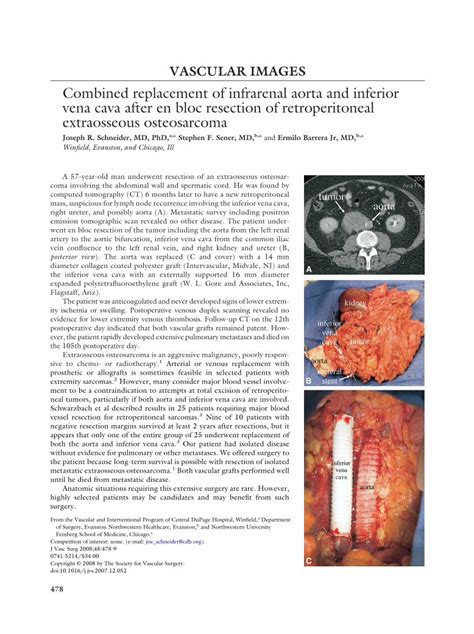 PDF Combined Replacement Of Infrarenal Aorta And Inferior Vena Cava