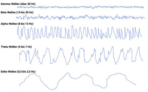 EEG Untersuchung Ablauf Messung Auswertung PraktischArzt