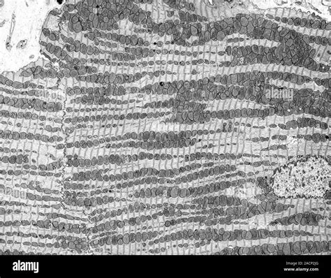 Cardiac Muscle Transmission Electron Micrograph Tem Of A