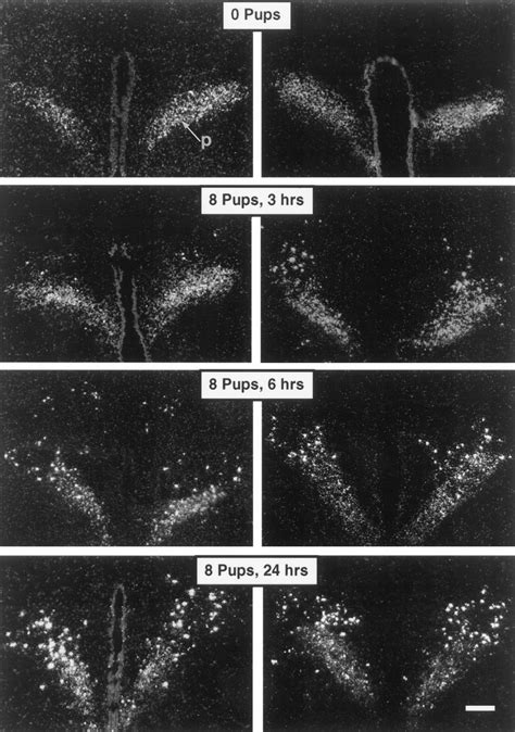 Darkfield Photomicrographs Of The Caudal DMH Area Showing The