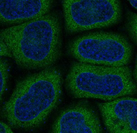 Map Lc A Rabbit Mab Sab Signalway Antibody