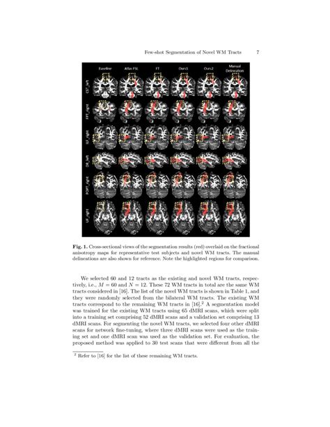 Knowledge Transfer For Few Shot Segmentation Of Novel White Matter