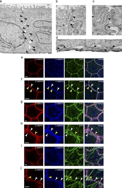 Actin Colocalizes With A Subset Of Junctional Complexes In Polarized