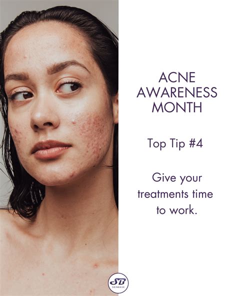 Acne Awareness Month Microdermabrasion Grid Post Series