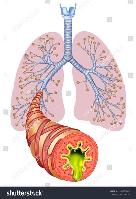 1,121 Mucus in lungs Images, Stock Photos & Vectors | Shutterstock