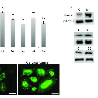 Analysis Of PAX Expression In Control And Cervical Cancer Cells RT PCR