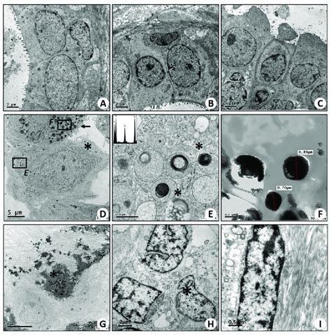 Transmission Electron Microscopy Of Breast Tissues A C Images Show