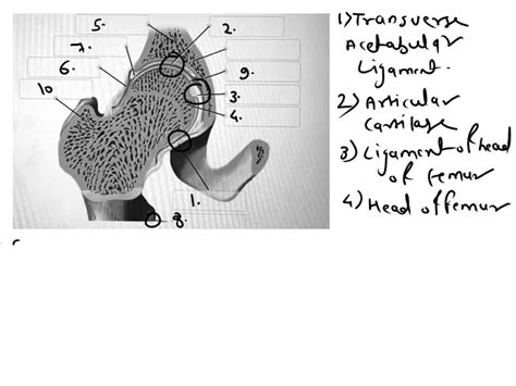 SOLVED Label The Structures Of The Pelvis Anterior Inferior Iliac