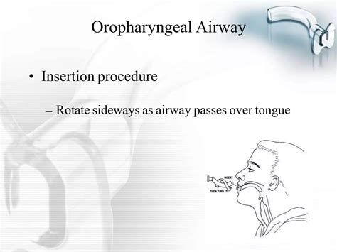 AIRWAY Management Ppt