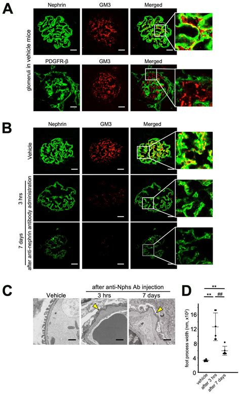 Localization of Nephrin, PDGFR-β and GM3 in glomeruli and the effect of... | Download Scientific ...