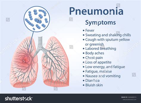 Pneumonia Symptoms Text Streptococcus Pneumoniae Bacteria Stock Vector ...