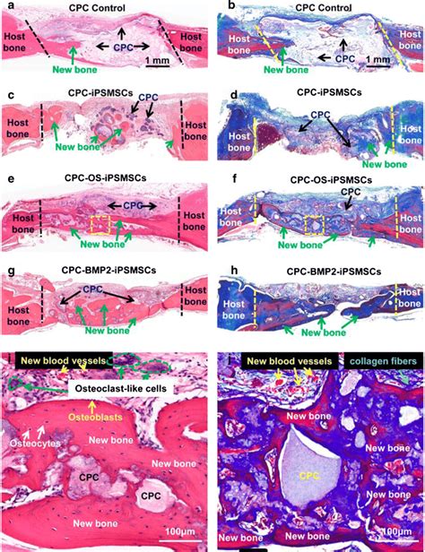 Histological Observations Of Bone Regeneration In Cranial Bone Defects Download Scientific