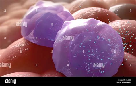 Diphtheria pseudomembrane hi-res stock photography and images - Alamy