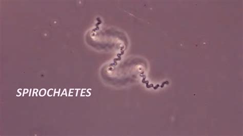 Spirochetes Gram Stain