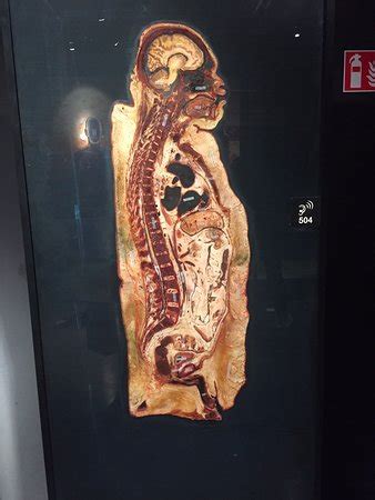 Body Worlds Amsterdam All You Need To Know Before You Go With