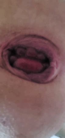 Pumping Asshole With Cock Pump Nude Pics Xhamster