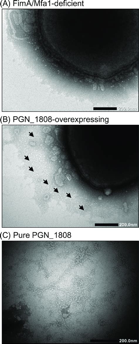 Transmission electron micrographs. Whole cells of the P. gingivalis ... 