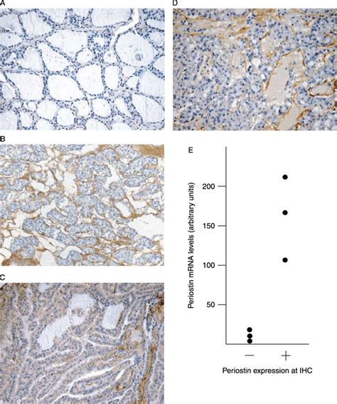 Immunohistochemical Detection Of Periostin In Normal Thyroid And