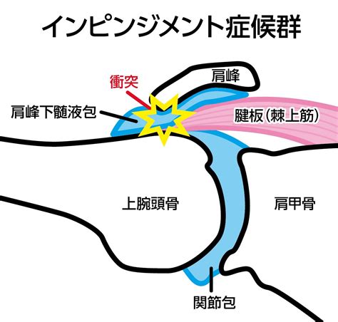 野球肩の原因と対処法、ケアやストレッチ方法を徹底解説！ 白石市で整体なら白石接骨院いとうへ！3万人以上を施術し紹介率95％！