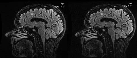 Magnetism - Questions and Answers in MRI