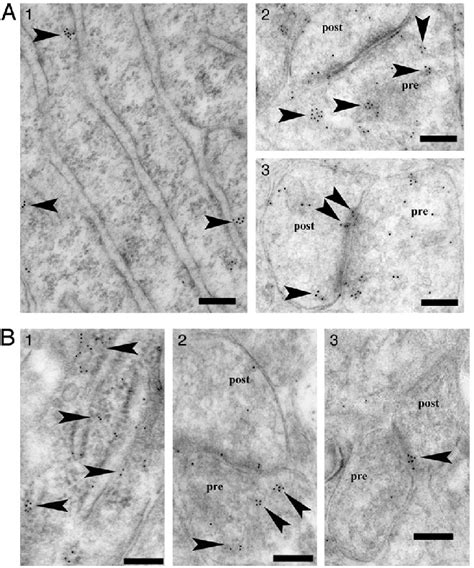 Immunoelectron Microscopic Analysis Of The Distribution Of P45017