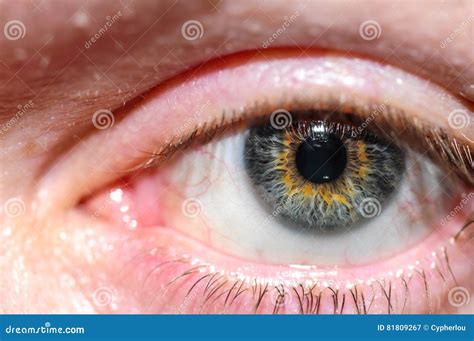 Human Eye Close Up Stock Image Image Of Human Detailed 81809267